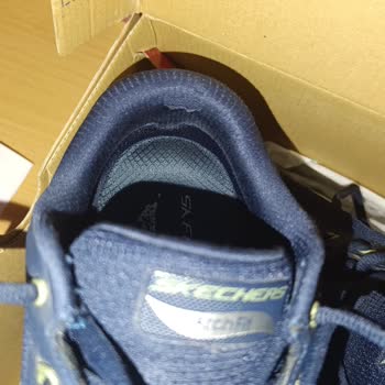 4 Ayda Yırtılan Ayakkabı İçin Red Cevabı Ve Mağduriyet