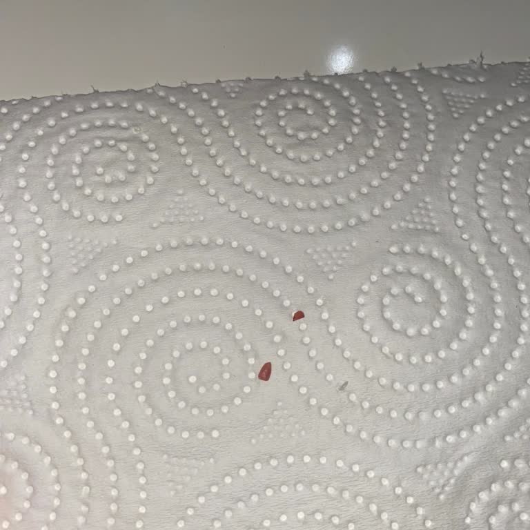 Vişneli Dondurmada Çekirdek Çıkması Sonucu Diş Kırılması Mağduriyeti