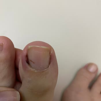 Pedikür Sonrası Sağlık Sorunları Ve İlgisiz İşletme Yaklaşımı