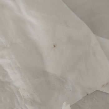 Sleepy Islak Mendillerde Küf Sorunu Ve Sağlık Riski: Maddi Ve Manevi Mağduriyet