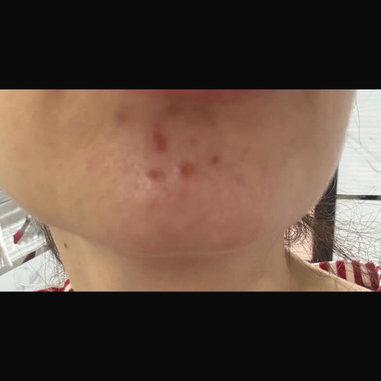 Enza Güzellik Merkezi'nde Yetersiz Hizmet Ve Cilt Tahrişi Yaşadım