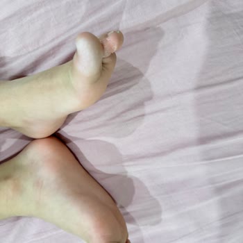 Kinetix Ayakkabı Oğlumun Ayağında Yara Ve Koku Yaptı, Değişim Talebim Reddedildi