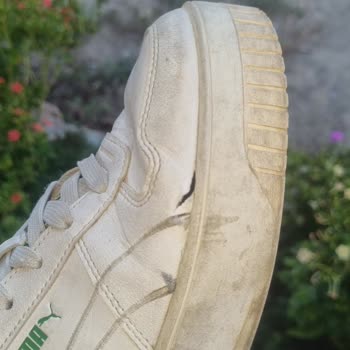 Satın Aldığım Ayakkabıda Erken Deformasyon Ve Garanti Kapsamında Destek Alamama