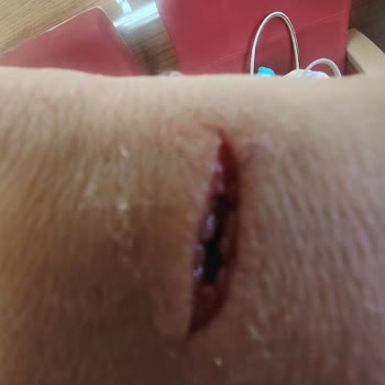 Acil Serviste İlgisizlik Ve Kaba Davranış Mağduriyeti