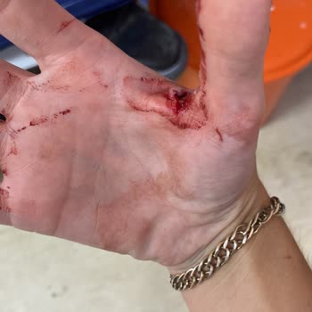 Marrakesh Alaçatı Otel Duş Kabininden Çıkarken Cam Aniden Kırıldı Ve Ellerim Kesildi!