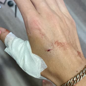 Marrakesh Alaçatı Otel Duş Kabininden Çıkarken Cam Aniden Kırıldı Ve Ellerim Kesildi!