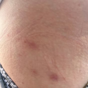 Koçluk Hizmeti Adıyla Satılan Ürünler Sağlığımızı Bozdu Para İadesi Yapılmıyor