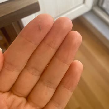 Yves Rocher Nemlendirici Krem Cildimde Tahrişe Ve Sivilcelenmeye Sebep Oldu