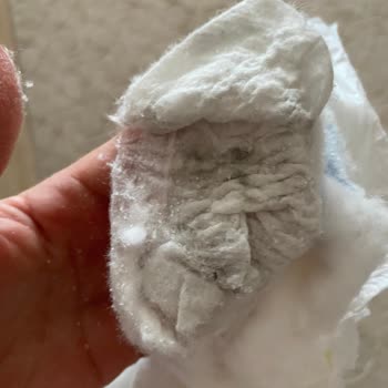 Molfix Bebek Bezinde Siyah Lekelerle Karşılaştım!