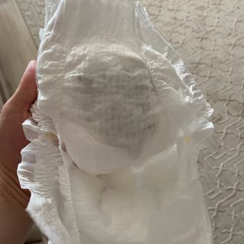 Molfix Bebek Bezinde Siyah Lekelerle Karşılaştım!