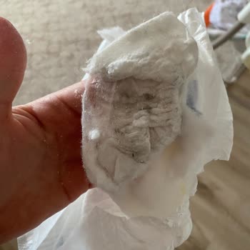 Molfix Bebek Bezinde Siyah Lekelerle Karşılaştım!