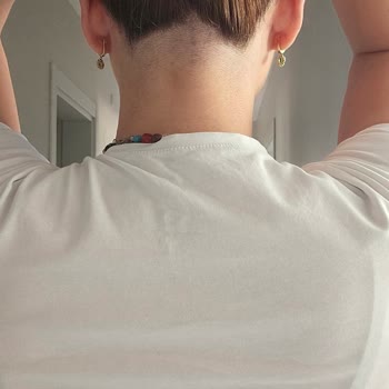 Lazer Epilasyon Sırasında Saçlarım Yanlışlıkla Tıraş Edildi, Mağduriyetim Giderilmedi