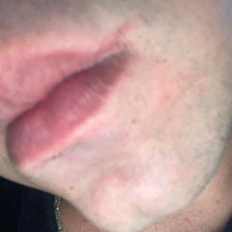 Diş Hekiminden Kötü Muamele Ve Tedavi Sırasında Fiziksel Zarar Gördüm