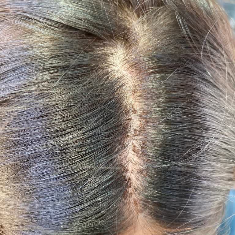 Saç Boyası Kullanımı Sonrası Sağlık Sorunu Ve Güven Kaybı