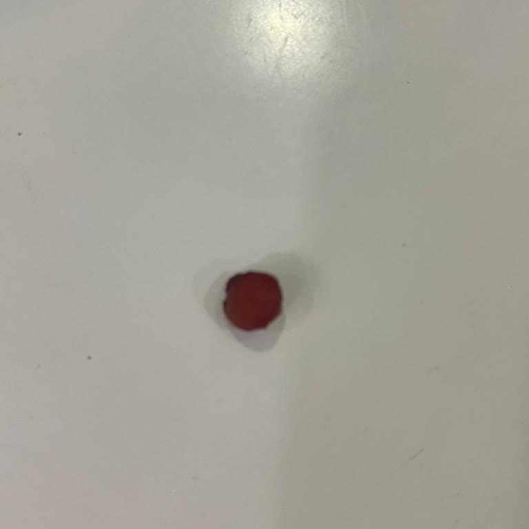 Ayıklanmış Vişnede Çıkan Çekirdek Diş Kırılmasına Neden Oldu