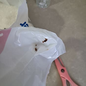 Toz Şeker Paketinde Yabancı Maddelerle Karşılaştım