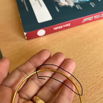 Garanti Kapsamındaki Bileziğin Hızla Deforme Olması Ve Müşteri Hizmetlerinin İlgisizliği