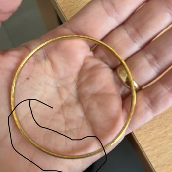 Garanti Kapsamındaki Bileziğin Hızla Deforme Olması Ve Müşteri Hizmetlerinin İlgisizliği