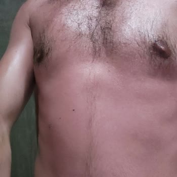 Aldığım Güneş Koruyucu Cildimde Yanıklara Sebep Oldu, Ürün Ve Satıcı İncelensin