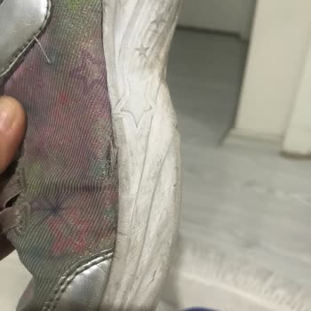 Skechers Çocuk Ayakkabısı İki Ayda Yırtıldı Mağaza Çözüm Sunmadı