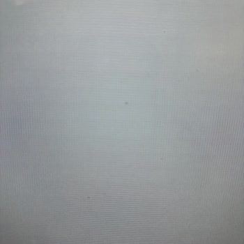 Samsung TV'de Tekrarlayan Ölü Piksel Sorunu Ve Yetersiz Servis Desteği