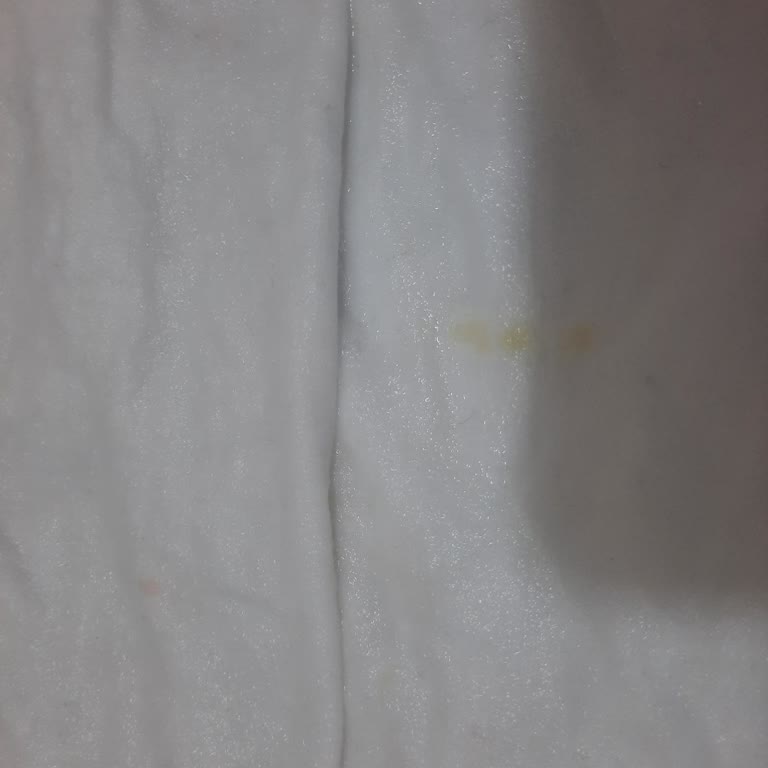 Leke Çıkarıcı Ürün Hiçbir İşe Yaramadı