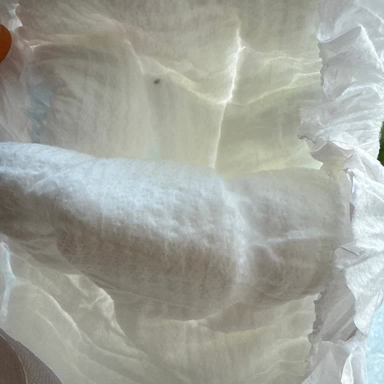 Bebek Bezinde Yabancı Madde Ve Pişik Sorunu: Güvenim Sarsıldı