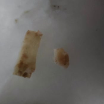 Aytaç Gıda Kavurma Ürününde Kemik Parçası Ve Kötü Koku Sorunu