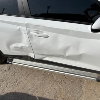 Eksper Onayı Gecikince Aracım Serviste Bekliyor