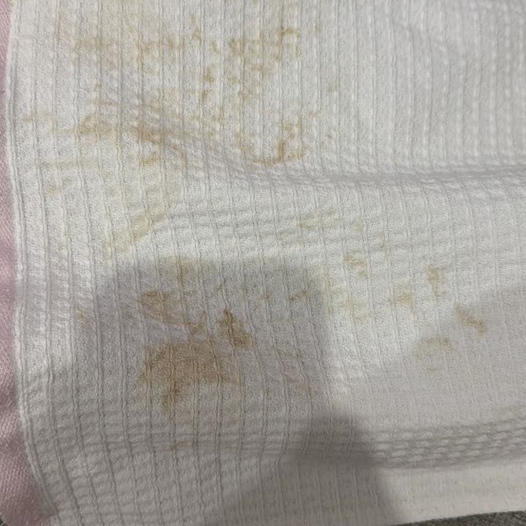 Yeni Alınan Çamaşır Makinesi Lekeleri Çıkarmıyor, Ürün Değişimi Talebi