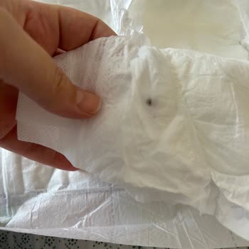 Sleepy Bebek Bezinde Sızıntı Ve Yabancı Madde Sorunu, Ücret İadesi Talebi