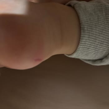 Ayakkabı Çocuğumun Ayağını Yara Yaptı İade Kabul Edilmedi Mağaza Çalışanları Kaba Davrandı