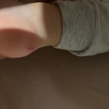 Ayakkabı Çocuğumun Ayağını Yara Yaptı İade Kabul Edilmedi Mağaza Çalışanları Kaba Davrandı