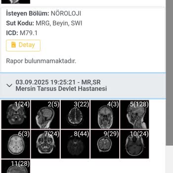 Mersin Tarsus Devlet Hastanesi'nde Emar Sonuçlarının Gecikmesi Ve İlgisizlik
