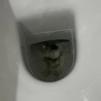 Aldığım Klozette Sürekli Leke Problemi Ve Yetersiz Çözüm Önerileri