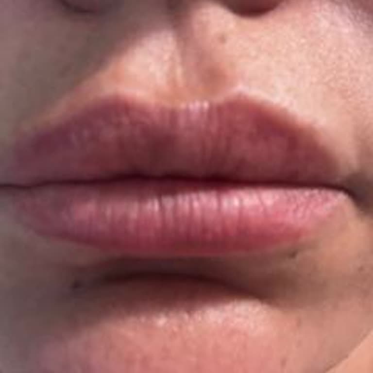 Bahar Babacan Beauty Center Dudak Renklendirme Sonrası Mağduriyet Ve Ücret İadesi Talebi!