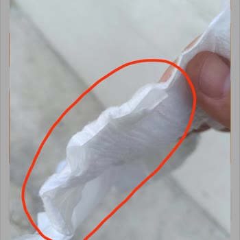 Defolu Çocuk Bezi Ve Çözümsüz Trendyol Müşteri Hizmetleri