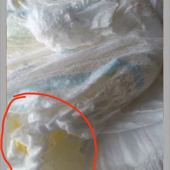 Defolu Çocuk Bezi Ve Çözümsüz Trendyol Müşteri Hizmetleri