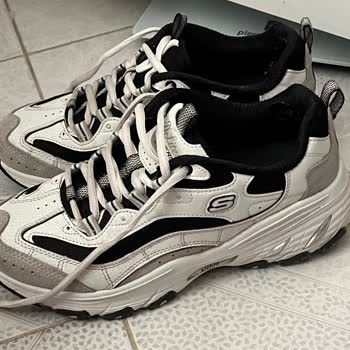 Skechers Ayakkabım 1 Ayda Yırtıldı Mağaza Değişim Talebimi Reddetti