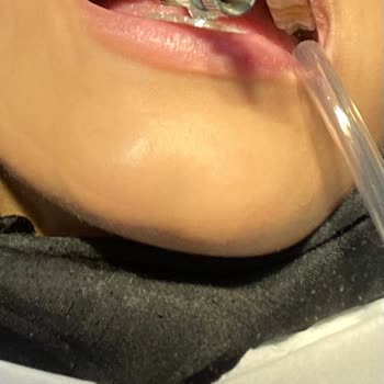 Yanlış Diş Tedavisi Sonrası Artan Ağrı Ve Maddi Kayıp