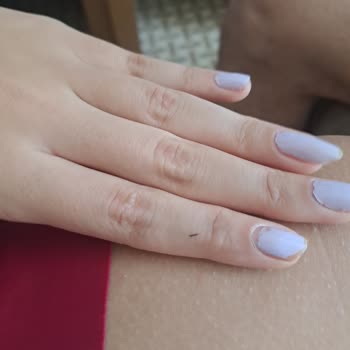 Hijyen Sorunları Ve Mağduriyet: Palmira Beach Otel Hayal Kırıklığı