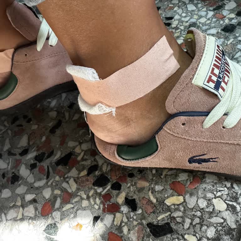 Yeni Alınan Lacoste Ayakkabı Ciddi Rahatsızlık Ve Yaralanmaya Sebep Oldu