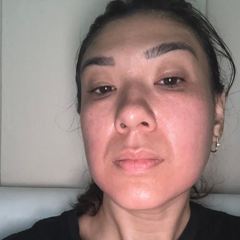 C Vitamin Serumu Cildimde Yanma Ve Kızarıklığa Sebep Oldu!