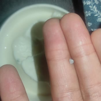 Dondurma İçinden Taş Çıkmasıyla Yaşanan Hayal Kırıklığı