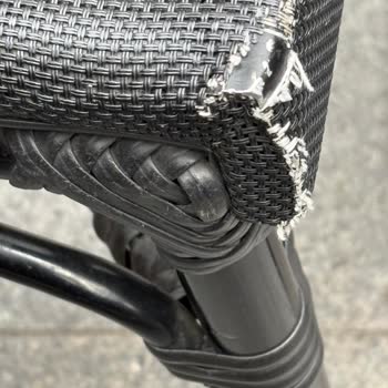 Eski Sandalye Yüzünden Pantolonum Yırtıldı Ve Bacağım Kanadı