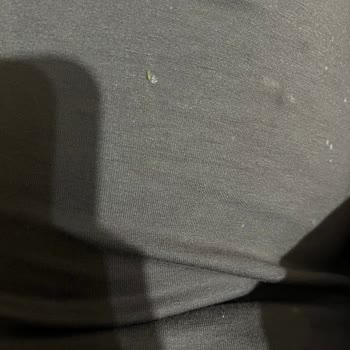 Kızılay Gazlı İçecekte Cam Kırığı Nedeniyle Yaşanan Sağlık Sorunu Ve Güvenlik Endişesi