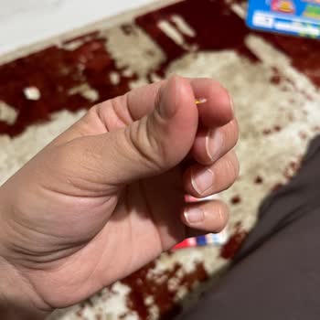 Kızılay Gazlı İçecekte Cam Kırığı Nedeniyle Yaşanan Sağlık Sorunu Ve Güvenlik Endişesi