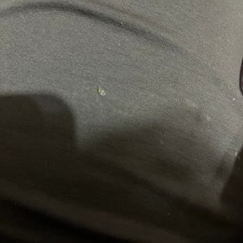 Kızılay Gazlı İçecekte Cam Kırığı Nedeniyle Yaşanan Sağlık Sorunu Ve Güvenlik Endişesi