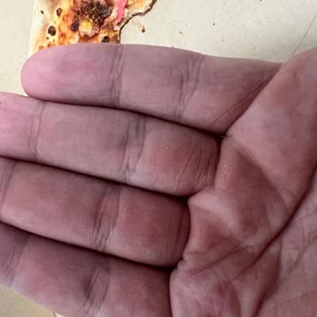 Trendyol Yemek Siparişte Hijyen Sorunu ve İade Talebine Yanıt Alınamaması