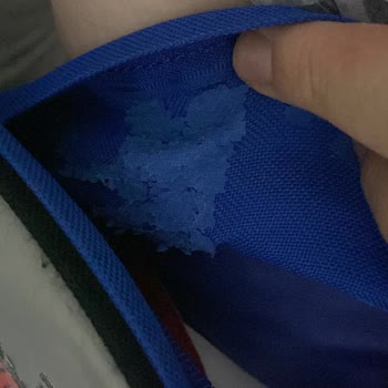 Kısa Sürede Deforme Olan Çocuk Çantası Ve Uzun İnceleme Süreci